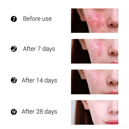 Tea Tree Bean Moisturizing Cream