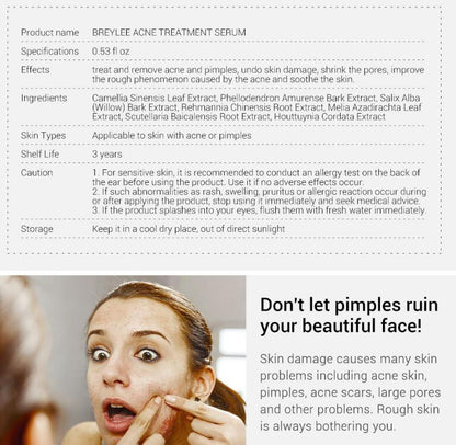 Breylee Facial Acne Repair Serum Treatment