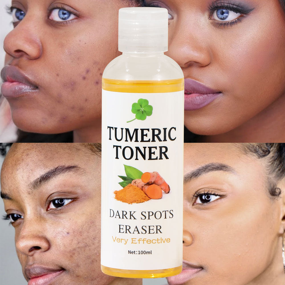 Skin Softening Turmeric Toner
